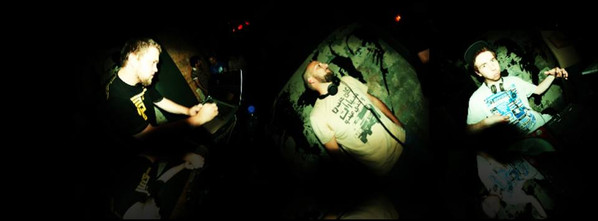 Restless Leg Syndrome