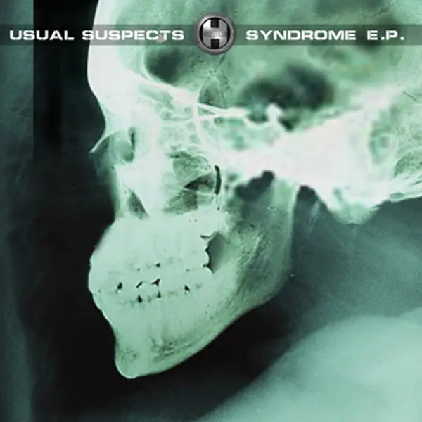 Syndrome E.P.
