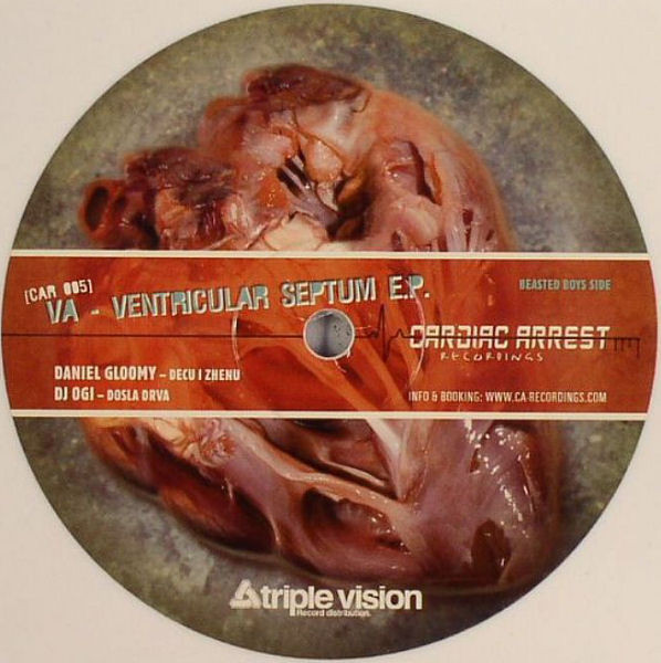 Ventricular Septum E.P.