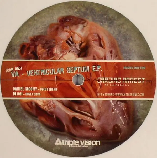 Ventricular Septum E.P.